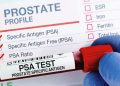 پروسٹیٹ کینسر: خاموش علامات اور بروقت تشخیص کی اہمیت